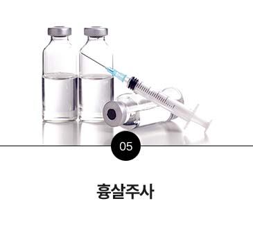 관리