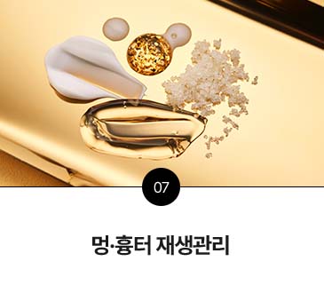 관리