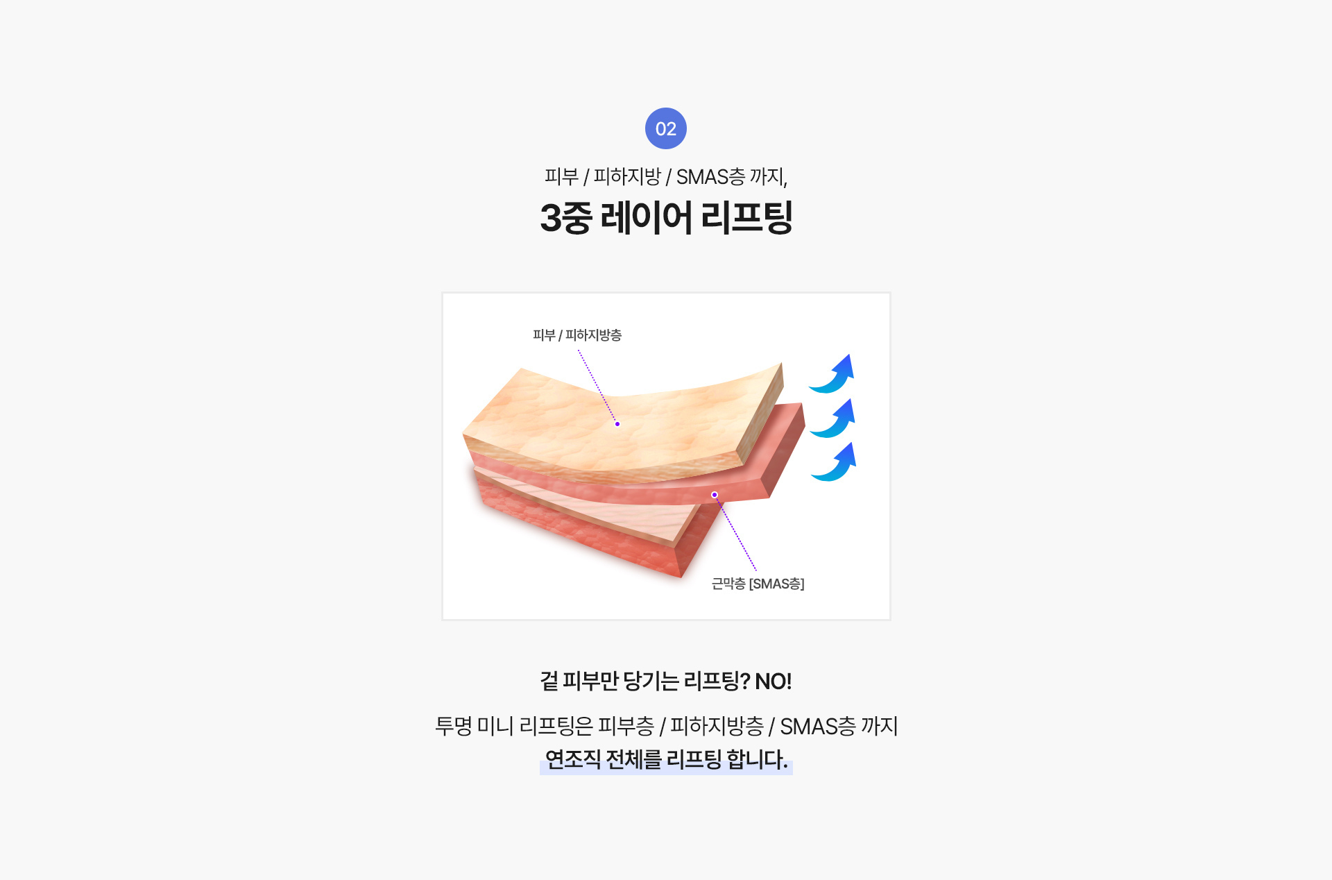 2 피부 / 피하지방 / SMAS층 까지,
3중 레이어 리프팅

겉 피부만 당기는 리프팅? NO!
투명 미니 리프팅은 피부층 / 피하지방층 / SMAS층 까지 연조직 전체를 리프팅 합니다




