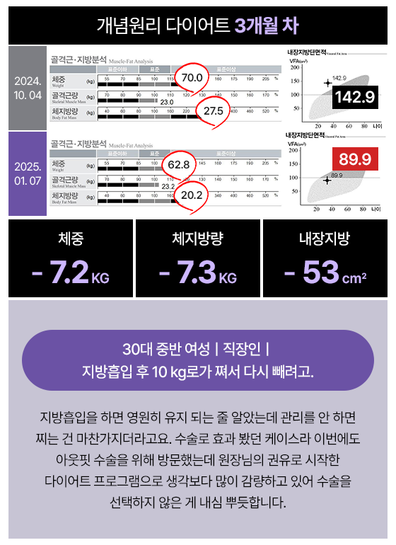 관리