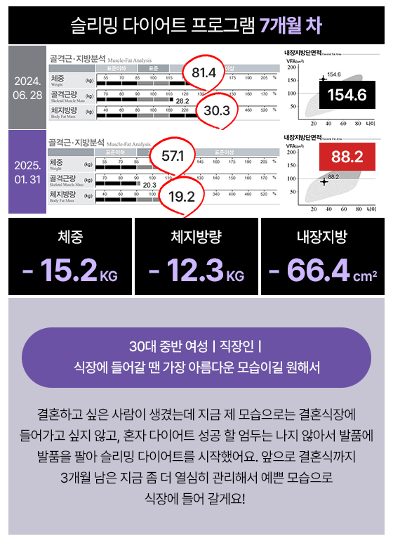 관리